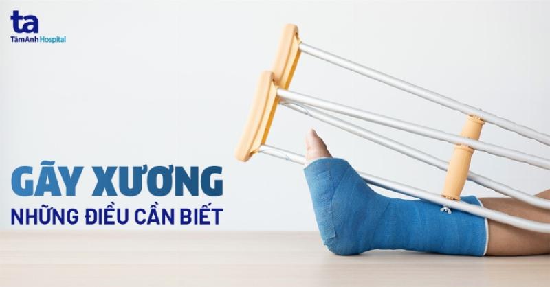 Hình ảnh minh họa người bệnh đang được bác sĩ thăm khám khớp gối sau chấn thương, nhấn mạnh tầm quan trọng của việc khám chuyên khoa khi nghi ngờ đứt dây chằng chéo trước